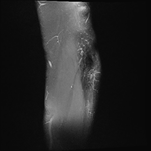 Click on the Serie image to view the images of Wieszt, Gnter